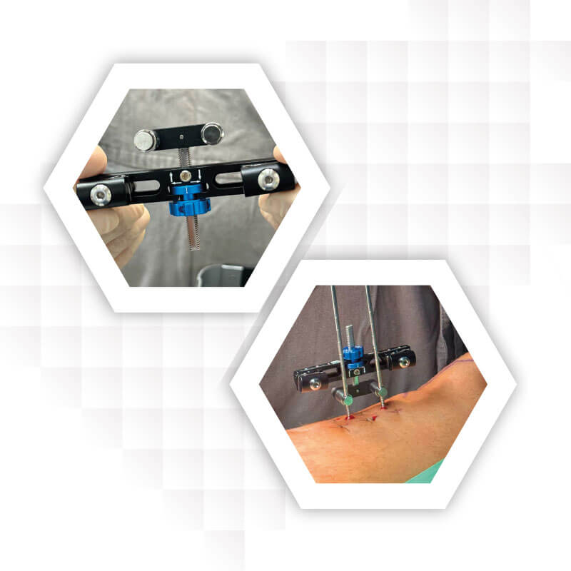 produtos-diabefix